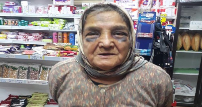 Demir çubukla dövdüğü 73 yaşındaki eşini, bakın ne hale soktu