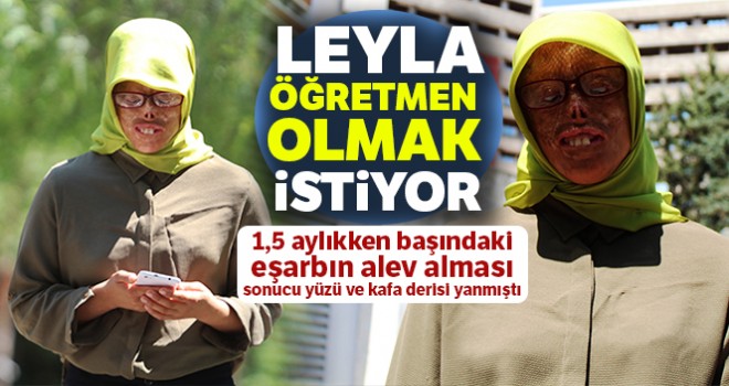  Yüz nakli heyecanı saran Leyla öğretmen olmak istiyor