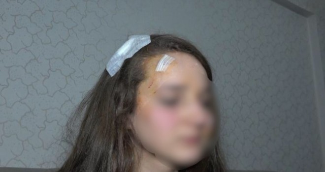 Genç kız, tanımadığı kişi tarafından sokak ortasında 'Muşta' ile darp edildi