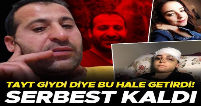 Sultangazi'de dehşet! Tayt giydiği için bu hale geldi, saldırgan serbest bırakıldı