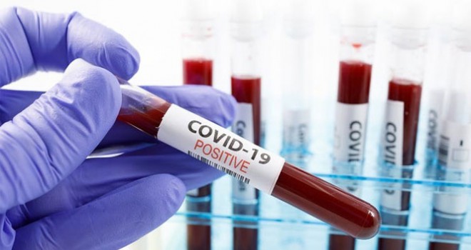 ABD'de koronavirüsten hayatını kaybedenlerin sayısı 85 bini geçti
