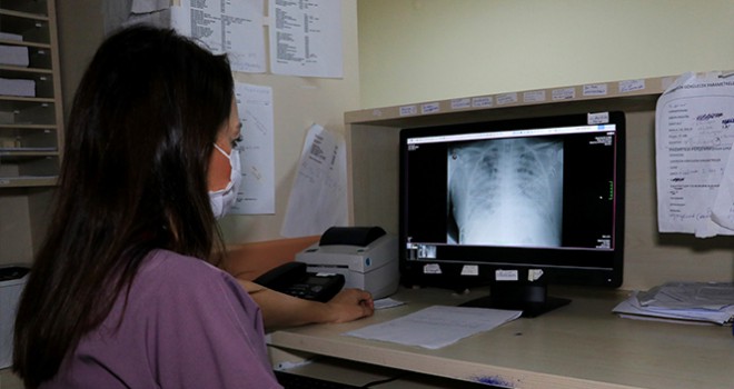 Koronalı hastaların akciğer röntgenleri korkuttu
