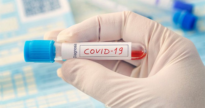 ABD'de Covid-19 salgınında can kaybı 59 bini, vaka sayısı 1 milyonu aştı