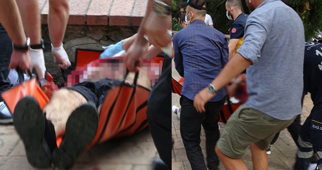 Maçka Parkı'nda dehşet: Şişeyi sağlık çalışanının başında parçaladı