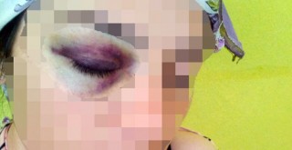 2 çocuğunun gözü önünde levye ile dayak yedi