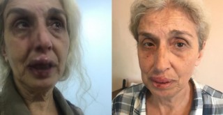 Sokak hayvanlarını beslerken başka kadınların saldırısına uğradı