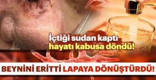  İçtiği sudan beyin yiyen amip kaptı hayatı kabusa döndü!