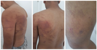 Zincire bağlanarak işkence edilen çocuğun baba ve amcası tutuklandı