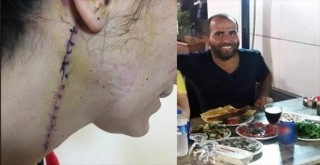 Genç kadına 80 dikiş atıldı! O adam şimdi...