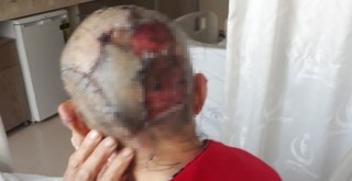 Köpek saldırısında dehşeti yaşadılar