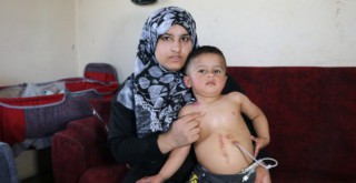 Yemek borusu olmayan Muhammed yardım bekliyor